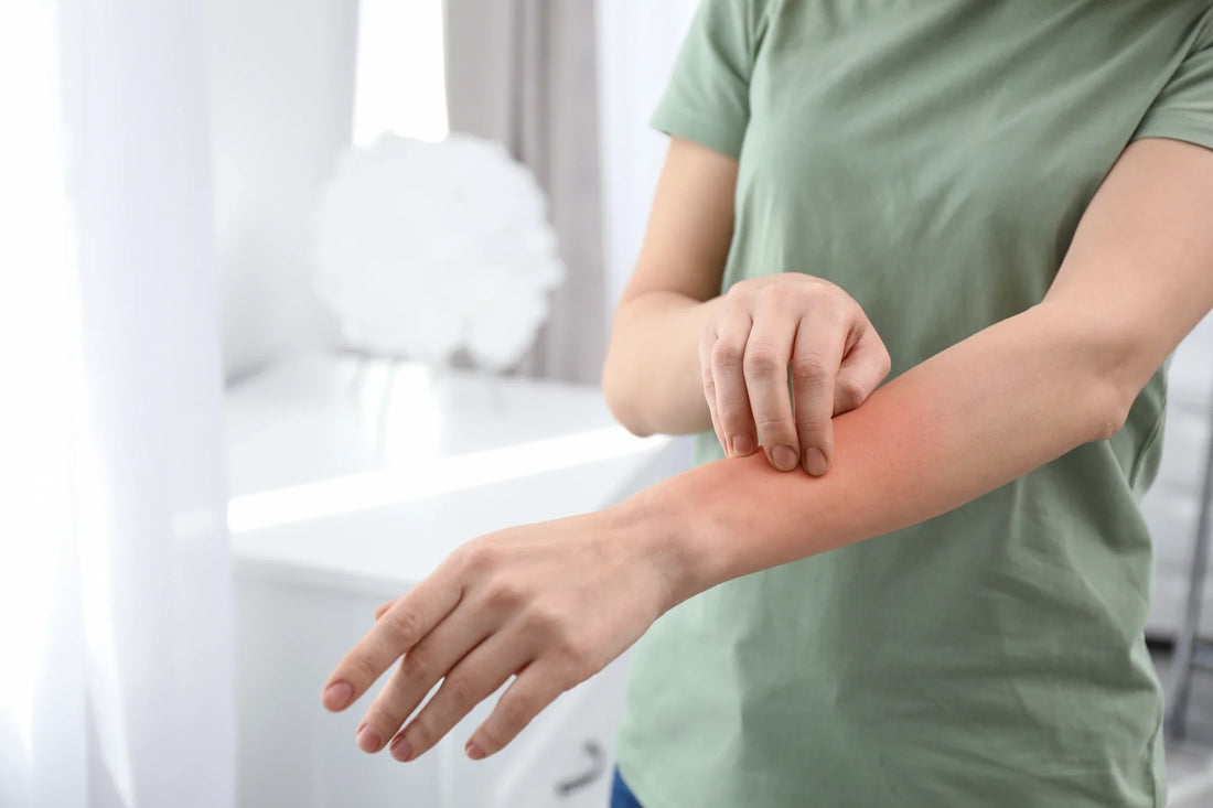 Eczema Skincare